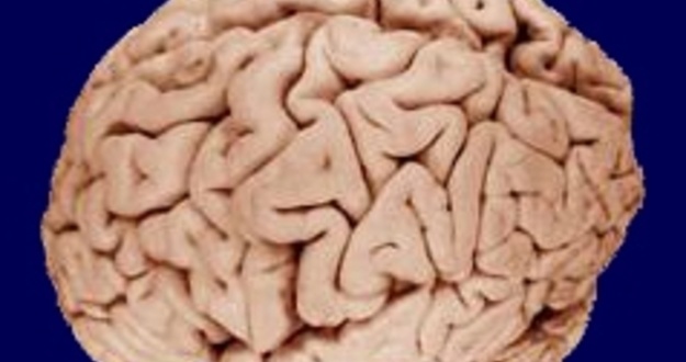 Right-Brain Marketing: Finding and Comprehending Motivated Sellers The human brain